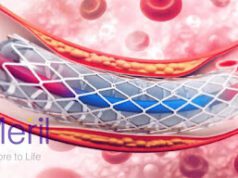 News Room : දෝෂ ඇතිවීම නිසා ඉන්දියානු Meril Life හෘද ස්ටෙන්ට් 3ක් භාවිතයෙන් ඉවතට! ~