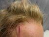 News Room : Carrie Bickmore reveals grisly head wound as she suffers horrific injury in accident: ‘Like a crime scene’ News Room Carrie Bickmore reveals grisly head wound as