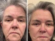 News Room : Rosie O’Donnell, 64, shares shock facelift pics after paying more than the price of a car only for no one to notice News Room Rosie ODonnell 64 shares shock facelift pics