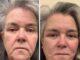 News Room Rosie ODonnell 64 shares shock facelift pics
