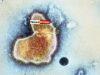 News Room : US drug regulator approves world’s first RSV vaccine News Room US drug regulator approves worlds first RSV
