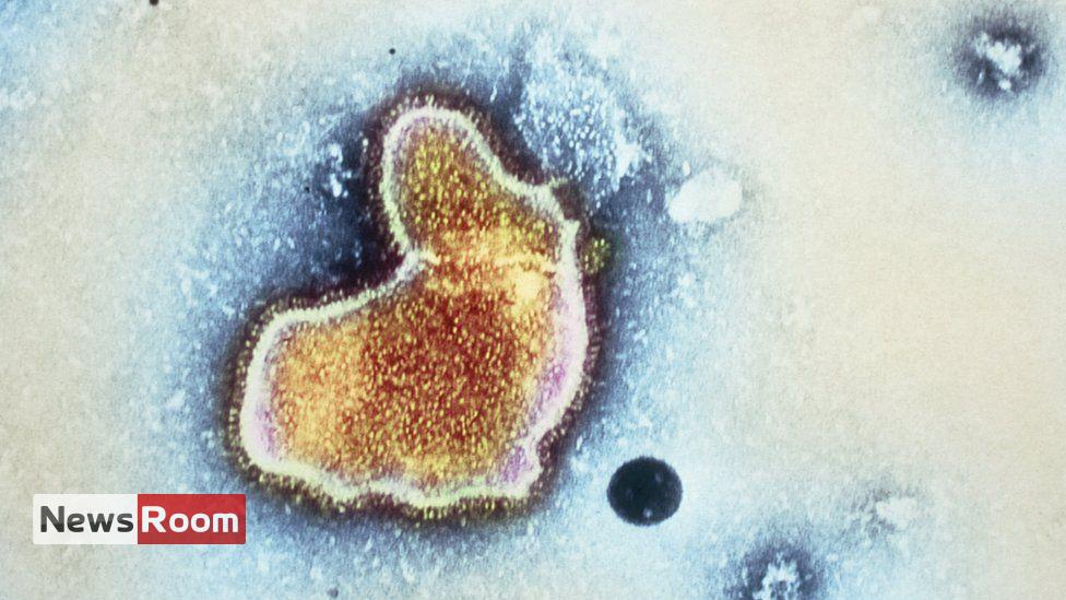 News Room : US drug regulator approves world’s first RSV