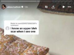 News Room : Abbie Chatfield denies she has had plastic surgery – as a follower accuses her of having her eyelids ‘cut off’