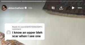 News Room : Abbie Chatfield denies she has had plastic surgery – as a follower accuses her of having her eyelids ‘cut off’