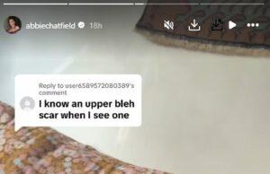 News Room Abbie Chatfield denies she has had plastic