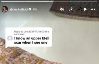 News Room Abbie Chatfield denies she has had plastic