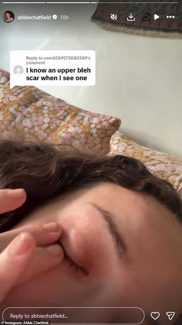 News Room : Abbie Chatfield denies she has had plastic