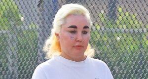 News Room : Amanda Bynes unveils latest body modification after getting lip fillers and dropping almost 30lbs on Ozempic