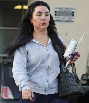 News Room Amanda Bynes shows off 30lb Ozempic weight