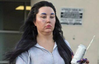 News Room Amanda Bynes shows off 30lb Ozempic weight