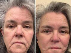 News Room : Rosie O’Donnell, 64, shares shock facelift pics after paying more than the price of a car only for no one to notice