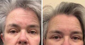 News Room : Rosie O’Donnell, 64, shares shock facelift pics after paying more than the price of a car only for no one to notice