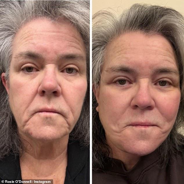 News Room : Rosie O’Donnell, 64, shares shock facelift pics after paying more than the price of a car only for no one to notice