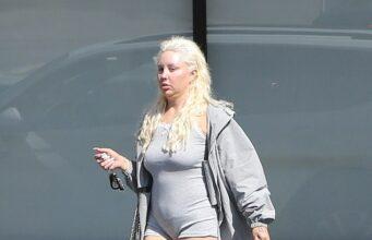 News Room : Amanda Bynes shows off Ozempic weight-loss transformation in gray romper after sharing plans to get gold TEETH News Room Amanda Bynes shows off Ozempic weight loss transformation